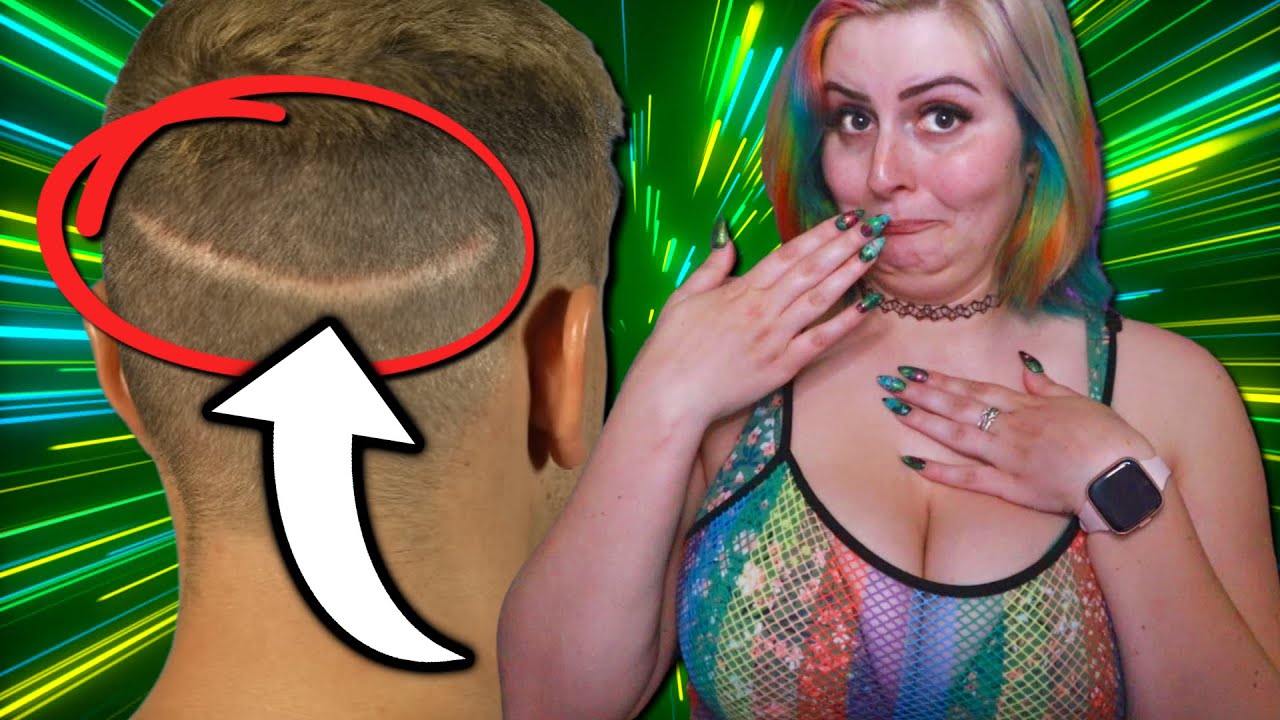 He got a BOOB IMPLANT in his HEAD?! | Botched Reaction S1E6