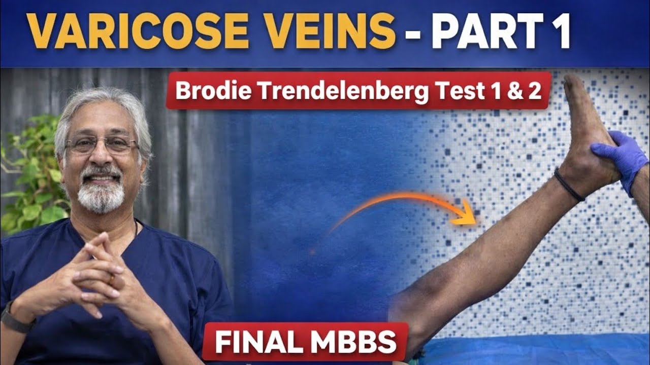Varicose Veins - Part I: Trendelenburg Test I & II – Step-by-Step Clinical Approach | MBBS Finals