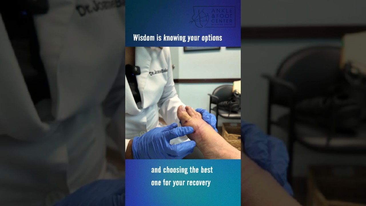 MIS Surgery Without Hardware? Know Your Options | Wednesday Wisdom