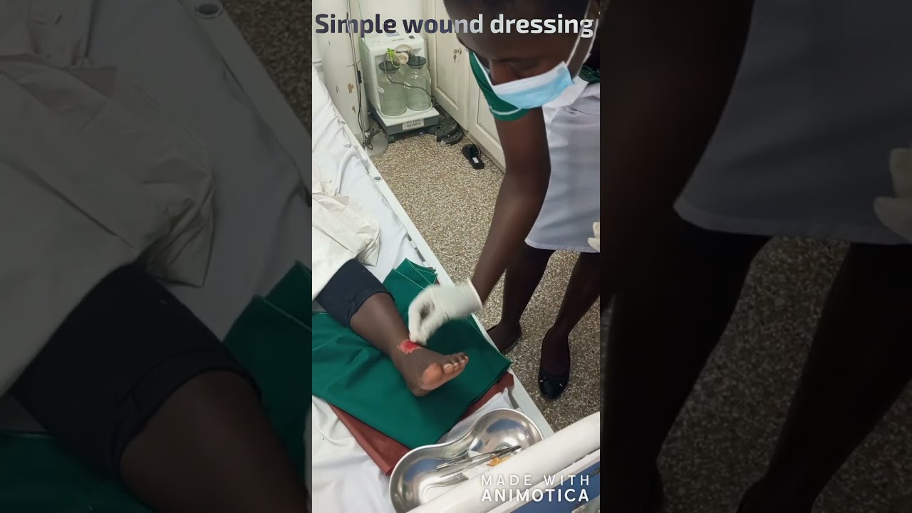 simple wound dressing 