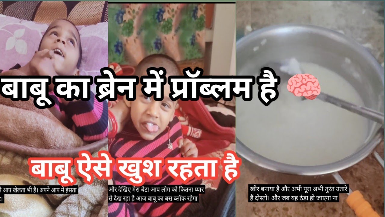 Mera beta ki bren me problem ke chalte bahut परेशानी hai #vlog #minivlog #youtubeshorts #trending 
