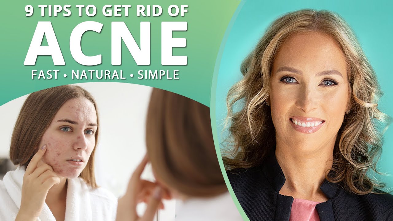 ACNE | 9 Tips to Get Rid of Acne | Dr. J9 Live