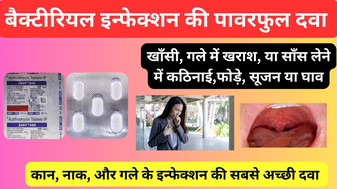 कान, नाक और गले के बैक्टीरियल इन्फेक्शन की पावरफुल दवा | Zady 500 Tablet Uses In Hindi