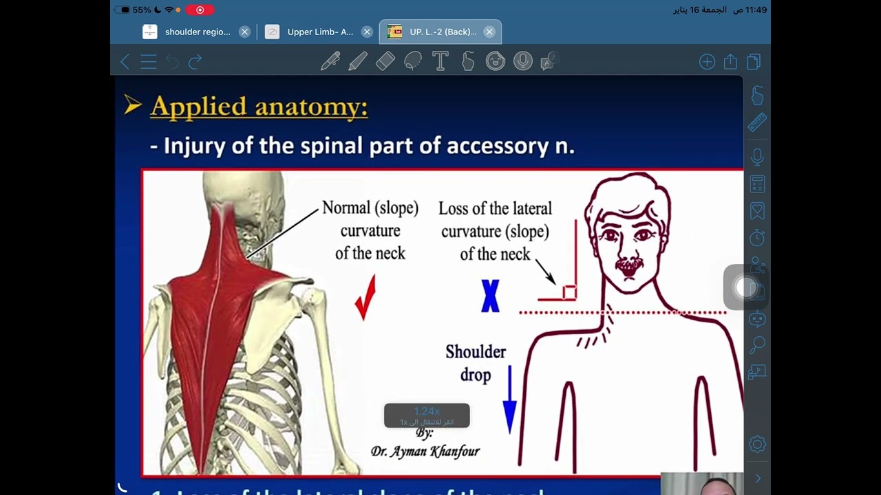 Anatomy of the first stage L3 The back muscles and-auscultation triangle