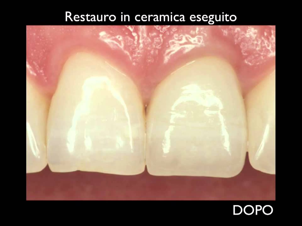 Estetica e salute dentale Stud...