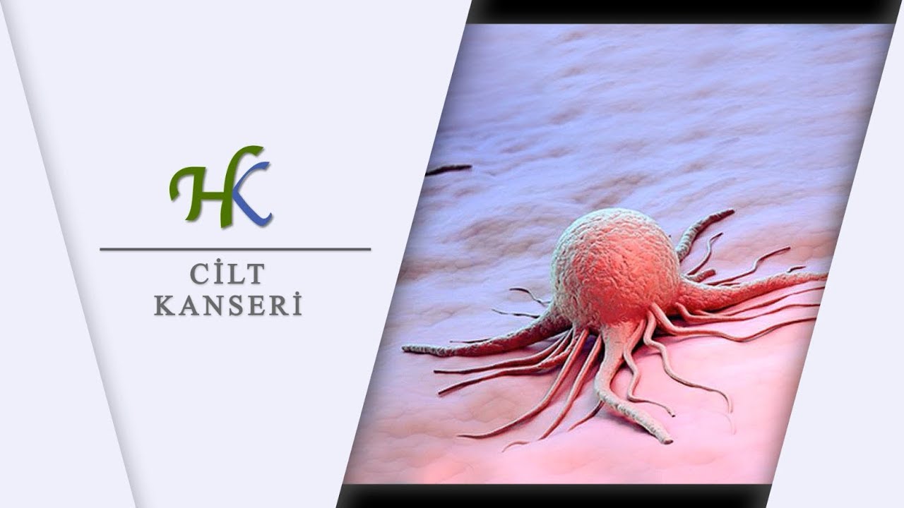 Cilt Kanseri - Prof. Dr. Hakan KARAGÖL