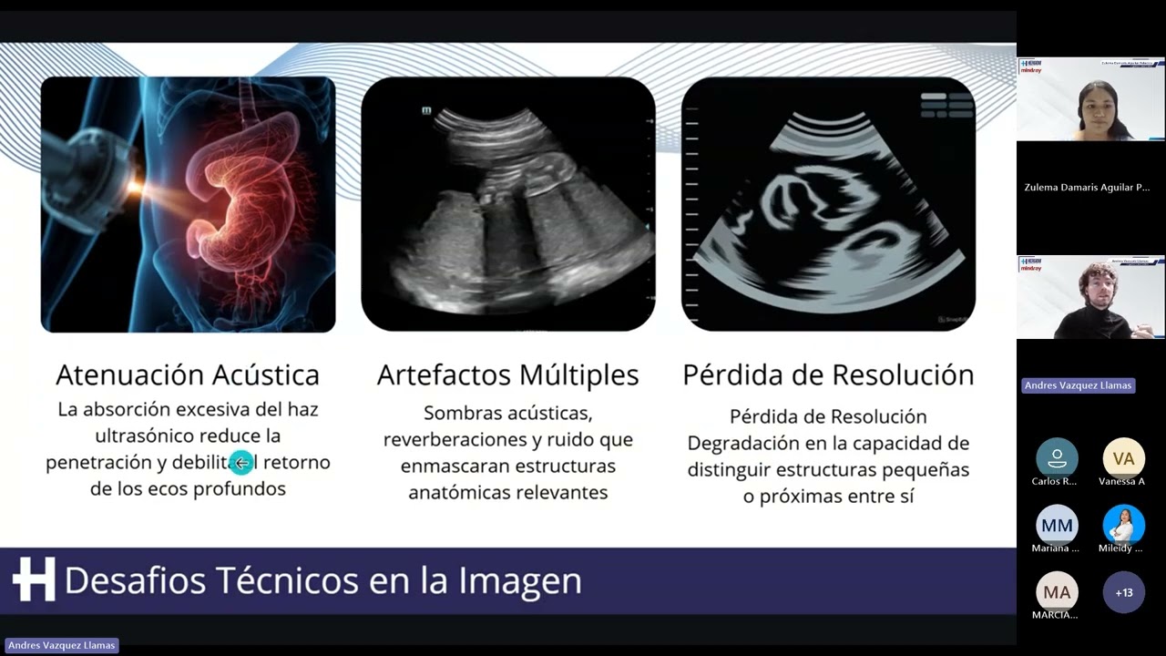 Calidad Diagnóstica sin Límites | Soluciones Mindray para Pacientes Difíciles (Webinar Completo)
