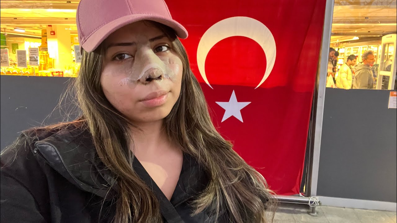 I went alone to Turkey for a nose job.. DR. Emin Toprak