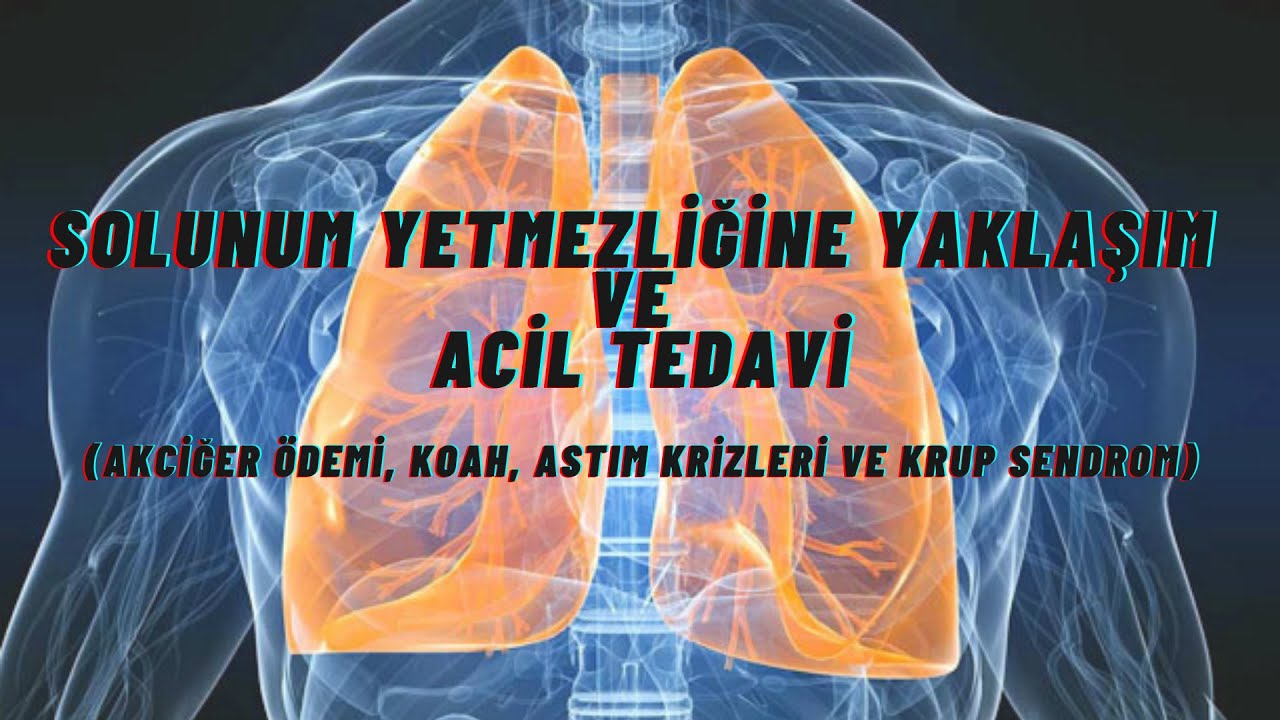 Solunum Yetmezliğine Yaklaşım ve Acil Tedavi (Akciğer Ödemi, KOAH, Astım Krizleri ve Krup Sendrom)