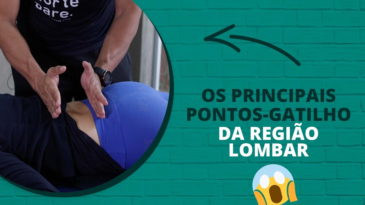 Os principais pontos gatilho da região Lombar