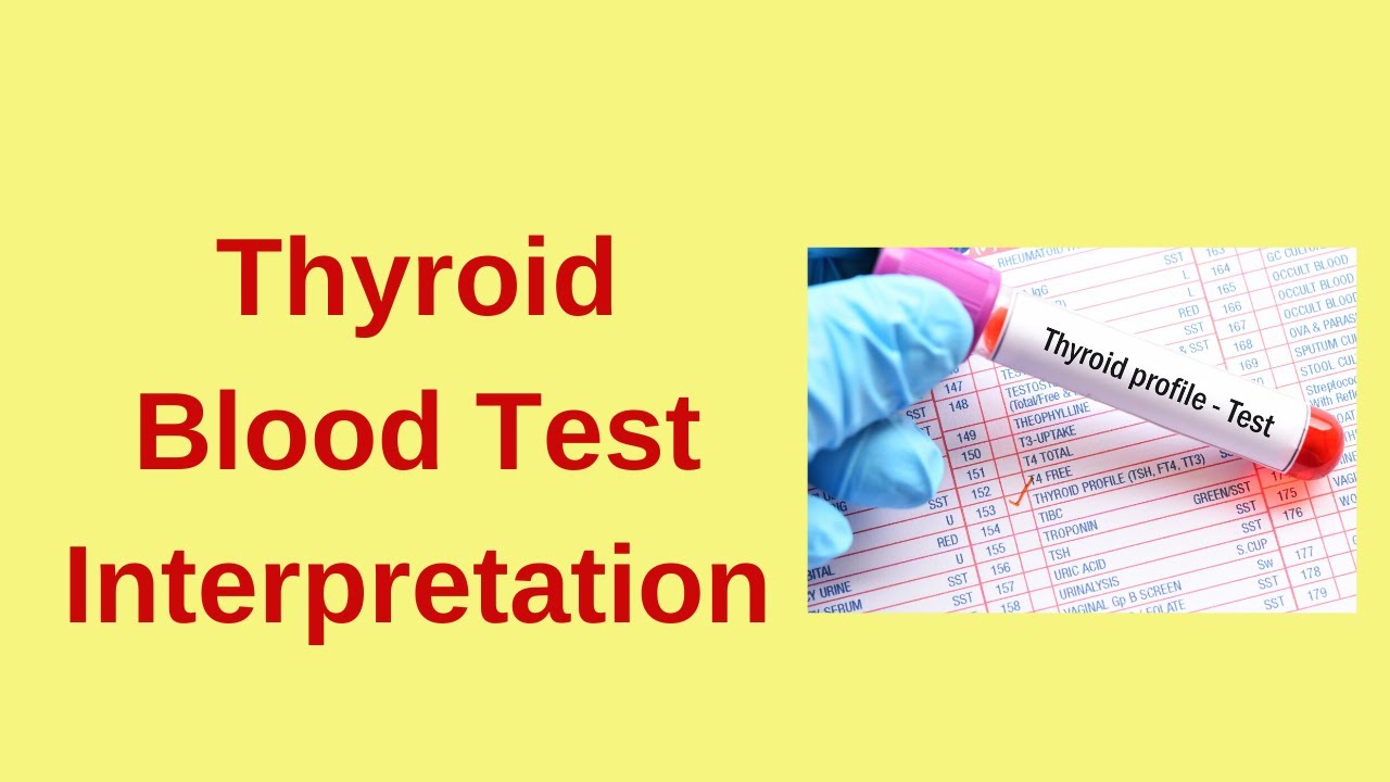 How To Read Your Thyroid Panel Results