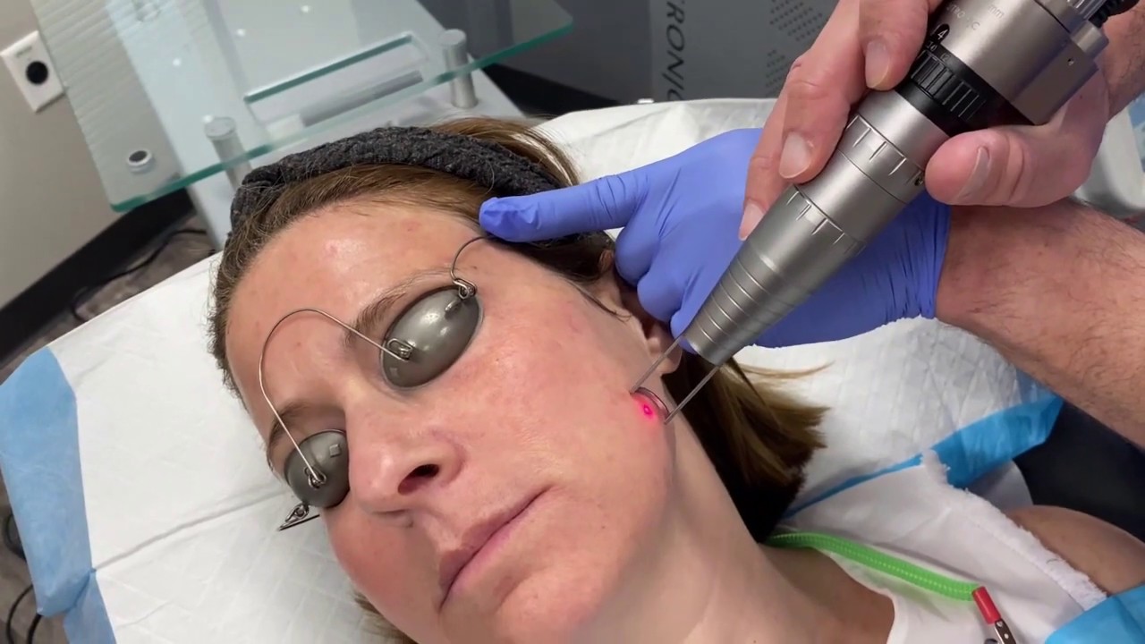 Lutronic Spectra & Ultra for Ultimate Pigment Clearance with Joel Cohen, MD