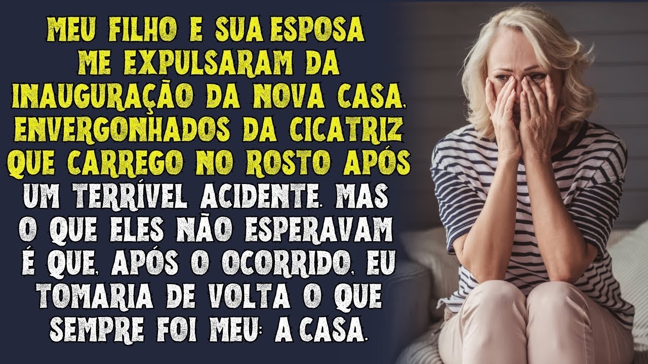 Meu filho e sua esposa me baniram da inauguração da nova casa por vergonha da minha cicatriz, mas