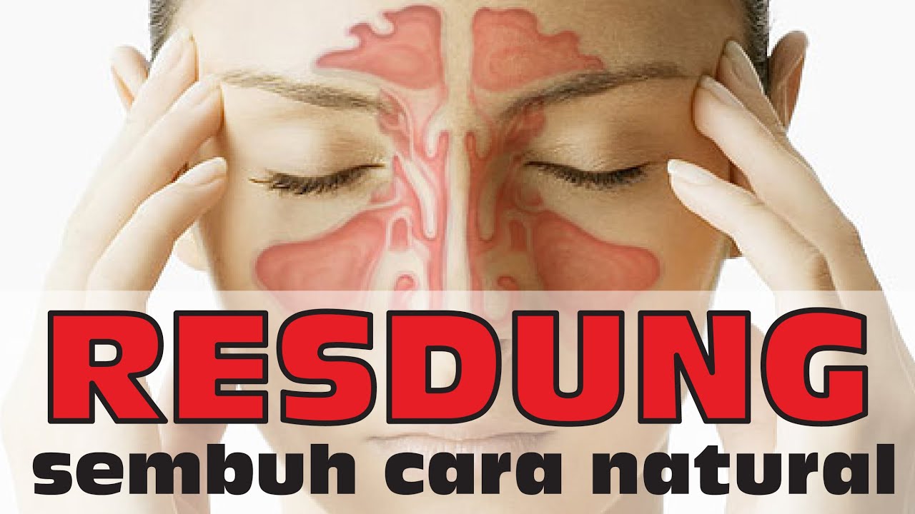RESDUNG CARA MUDAH UNTUK SEMBUH SECARA NATURAL - Dr. Noordin Darus