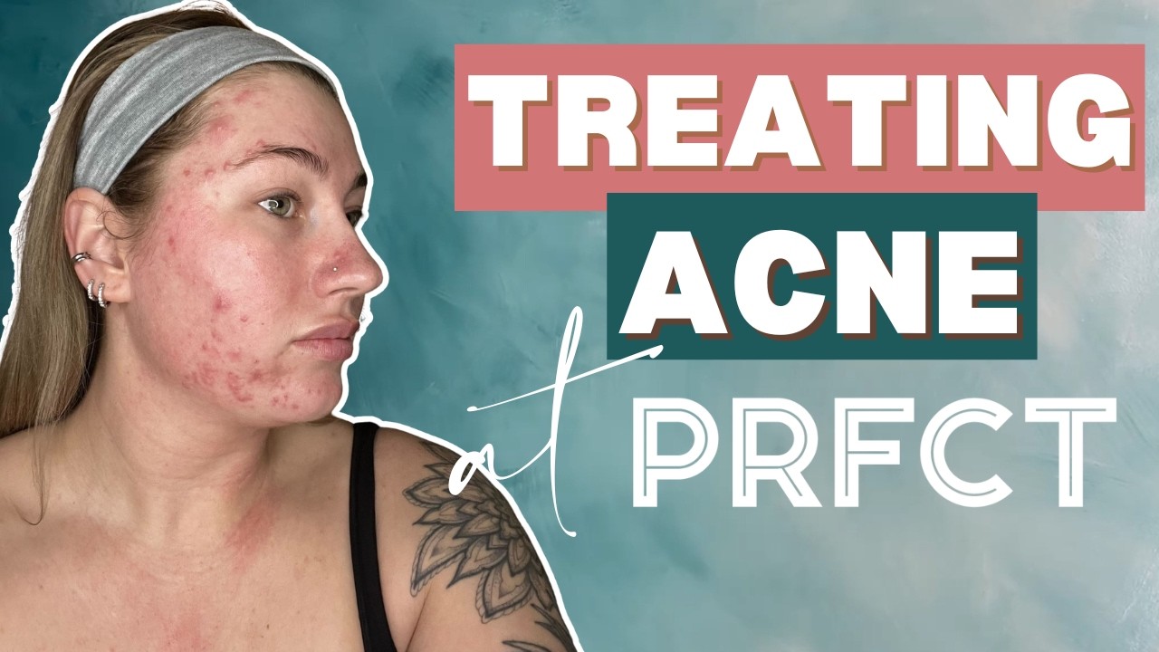 The 4 Pillars of Clear Skin |A Smarter Way to Treat Acne|