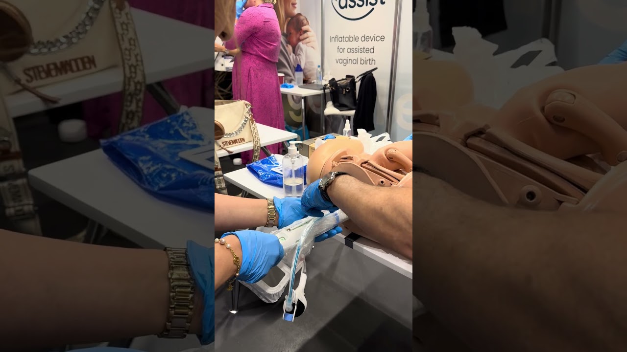 Odon assist&hellip;. New device instead of vacuum or forceps#baby#deliverychallan