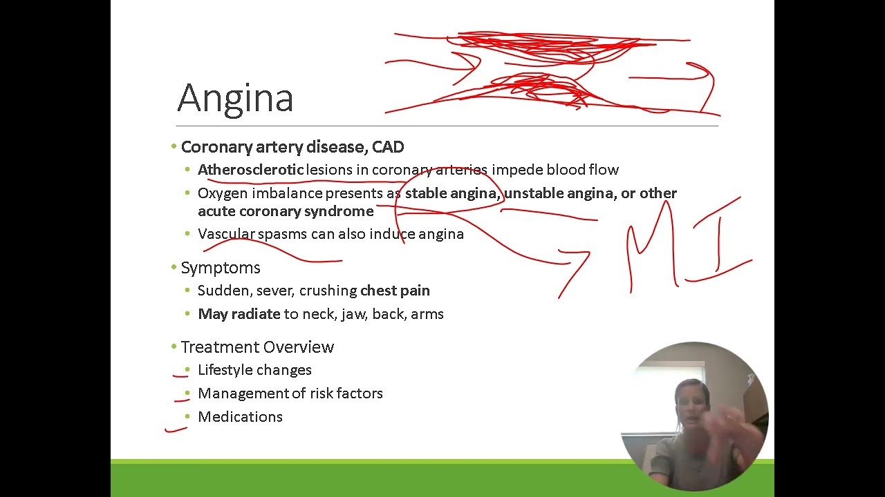 Pharmacology: Treatment of Angina