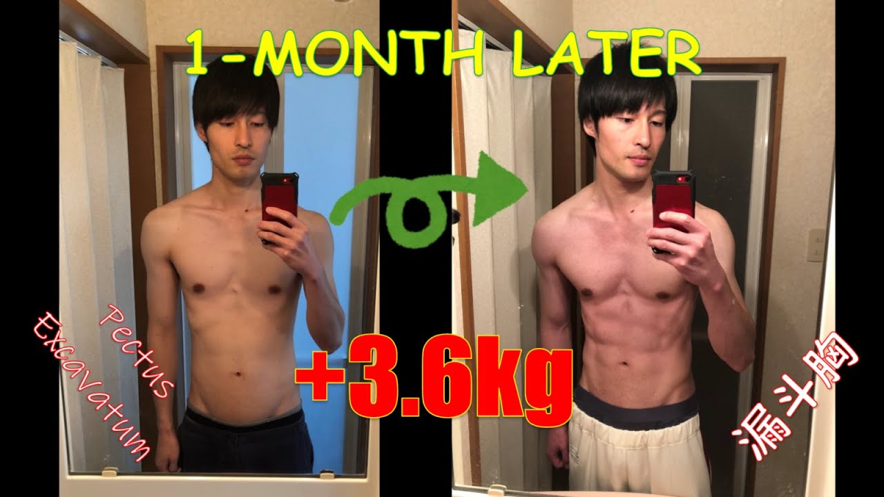 【Pectus Excavatum】1-Month Body Transformation【漏斗胸】ガリガリ克服筋トレ！～１か月の成果～