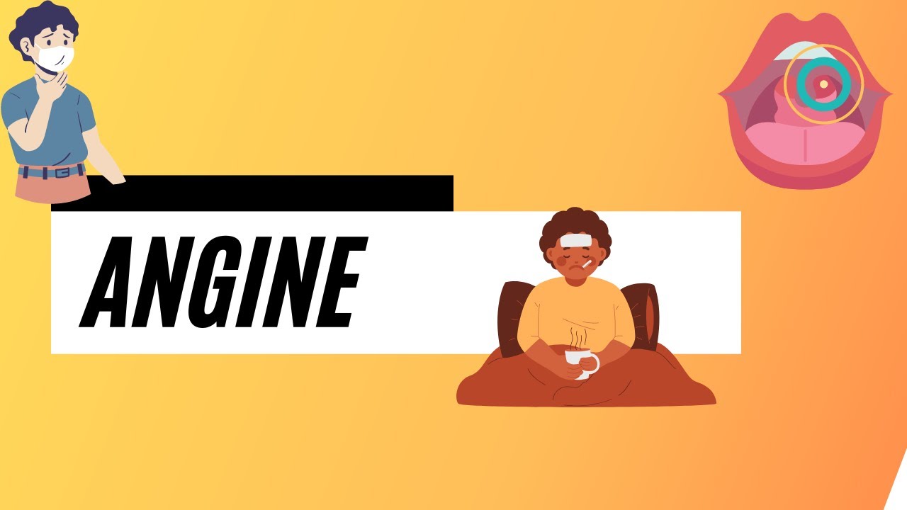 Les angines aigues - Cours ORL/P&eacute;diatrie | Revisimed