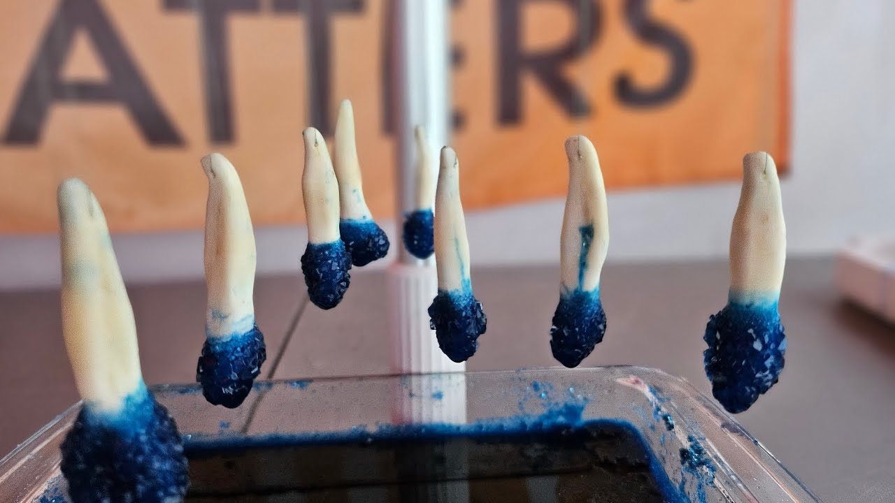 Moose Teeth Harvesting with Resilient Inuk