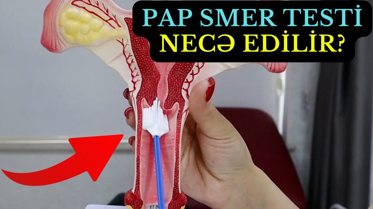 Papsmer Testi - Necə Edilir?