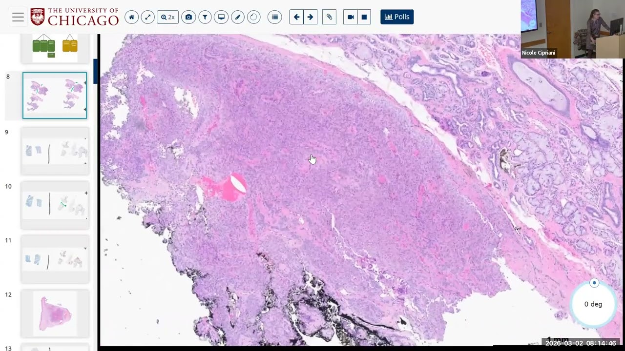 2026 03 02 Cipriani Salivary Unknowns