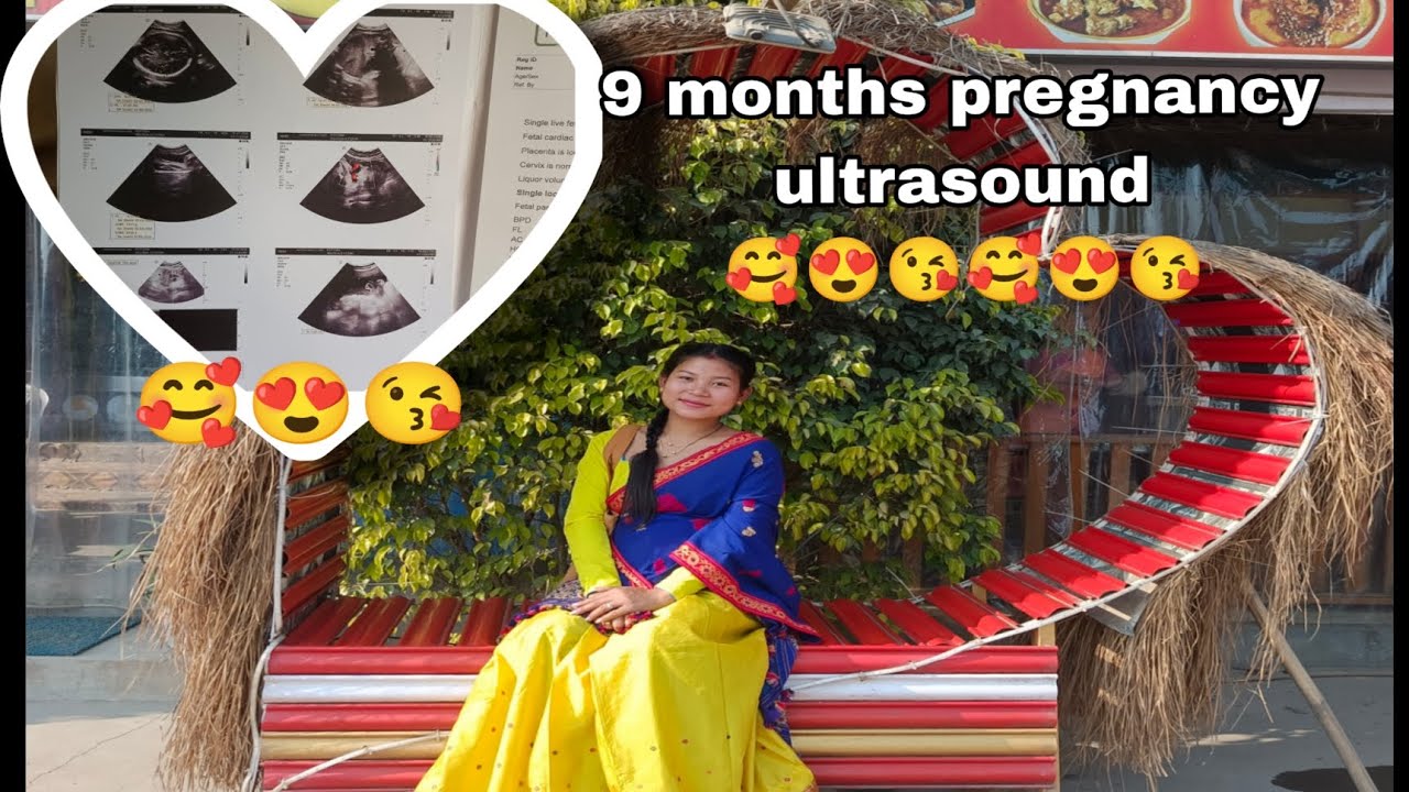 Finally 😮‍💨ultrasound😍🥰 complete😊😃