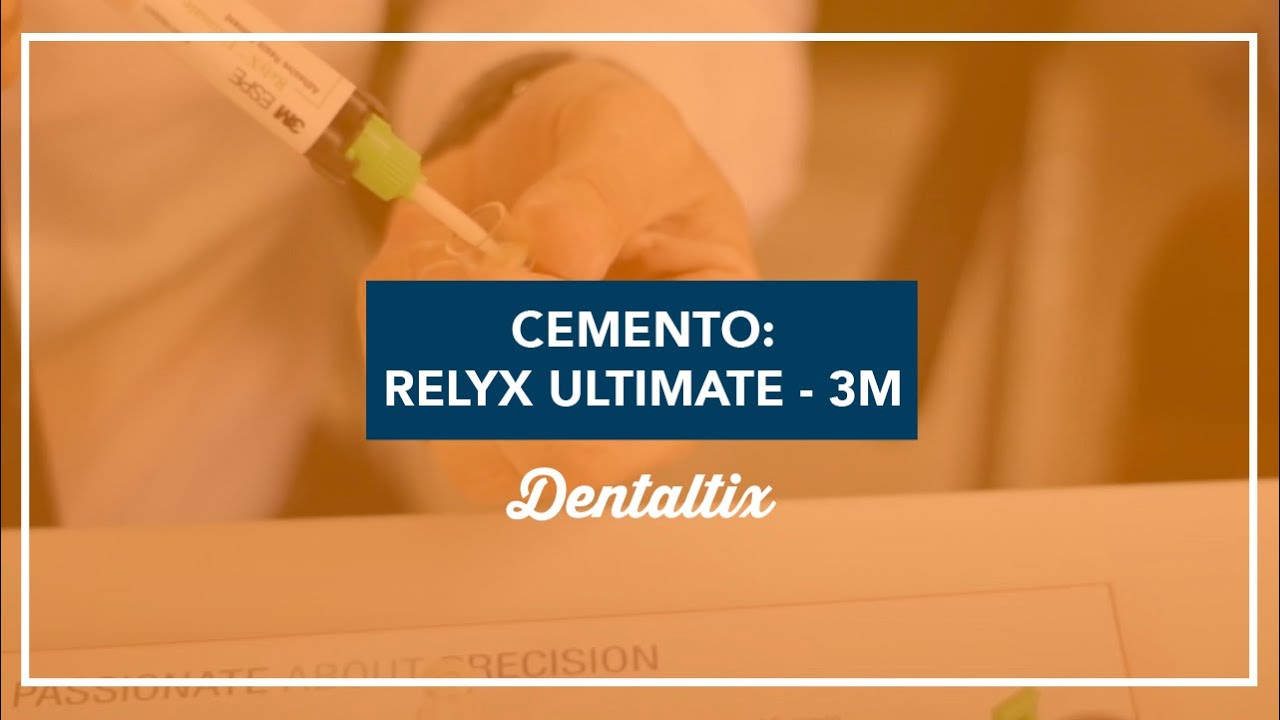Ventajas y usos del Relyx Ultimate de 3M