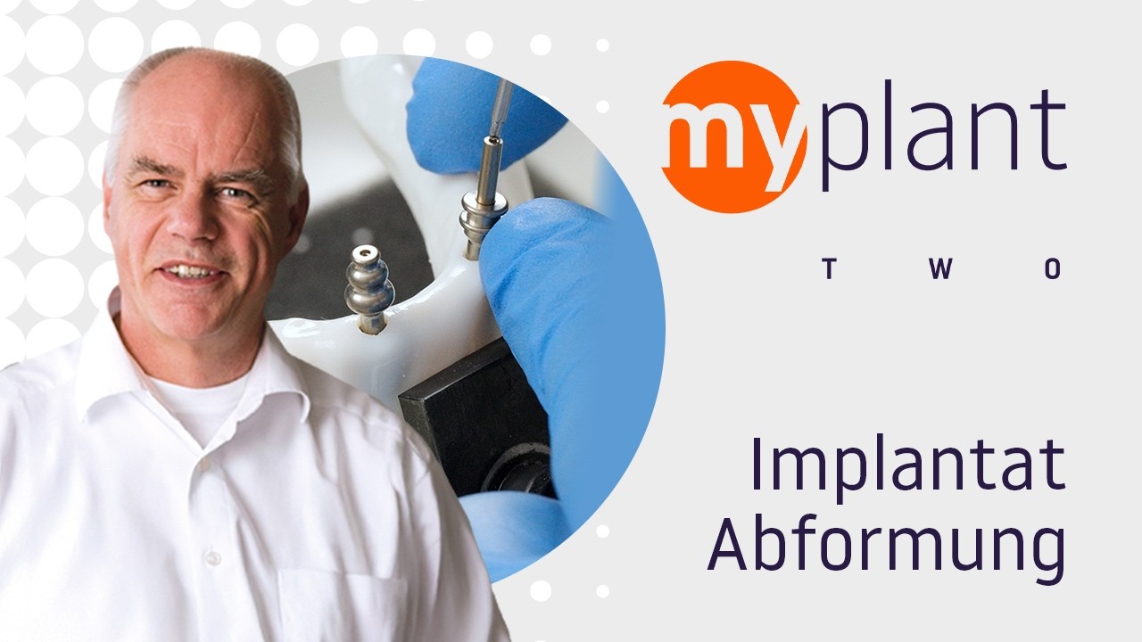 Die offene und geschlossene Abformung mit myplant two Implantaten von MEISINGER