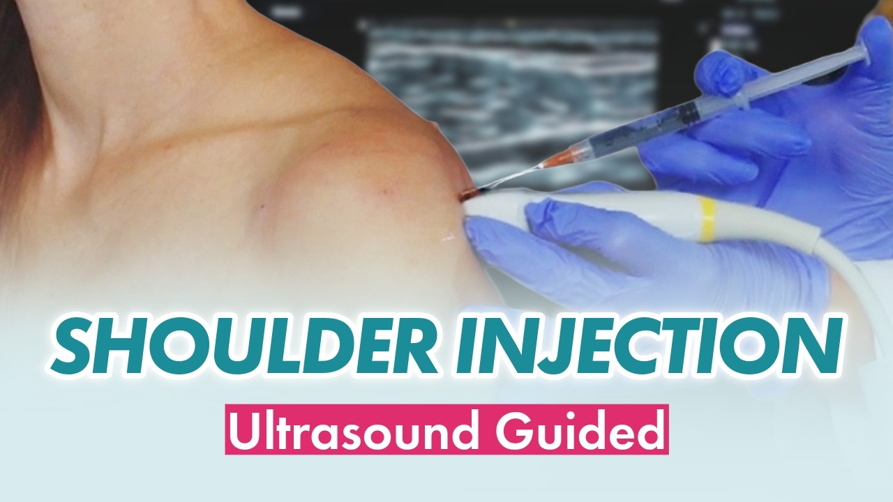 Shoulder Injection Technique: Ultrasound-Guided PGH