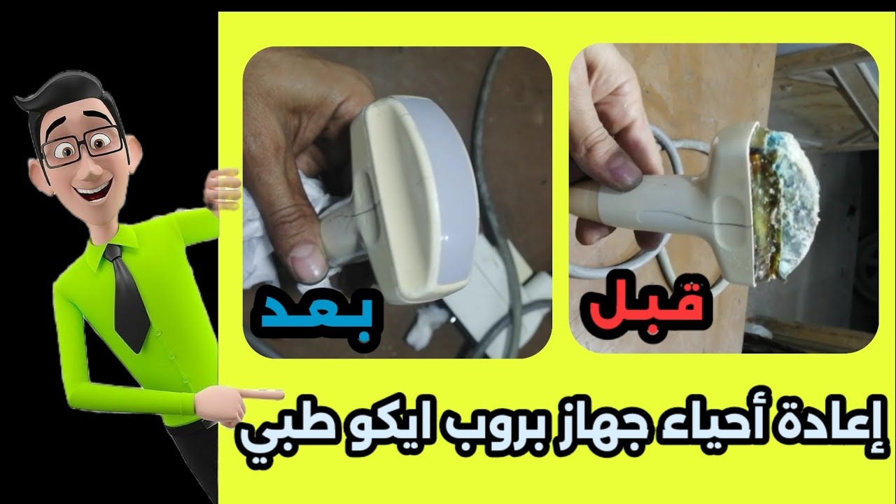 اصلاح بروب سونار ايكو #اجهزة_طبية #الوسن-للالكترونيات