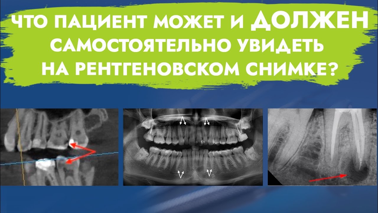 Рентгеновское исследование. Практический минимум для пациентов.