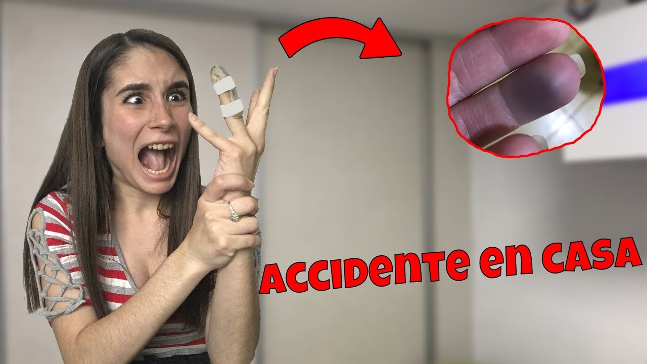 TUVE UN ACCIDENTE EN CASA *ME FRACTURE EL DEDO* | Melina Vallejos