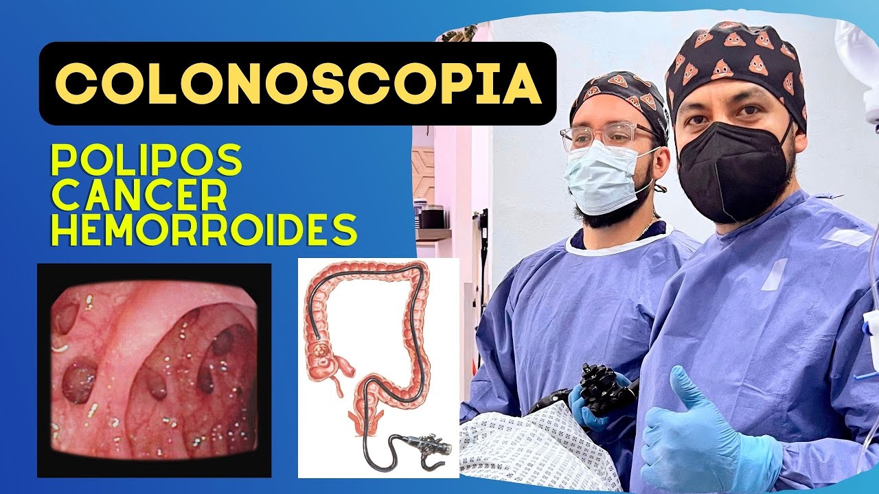 ¿Quién debe hacerse una Colonoscopia? | Dr Juan Pablo Hernandez | Parte 1