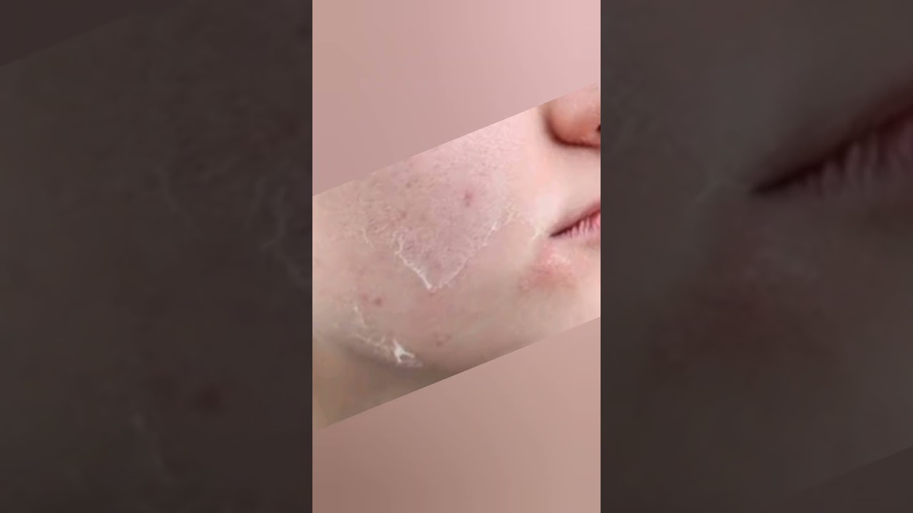 Ponds moisturizing cream #dryskin