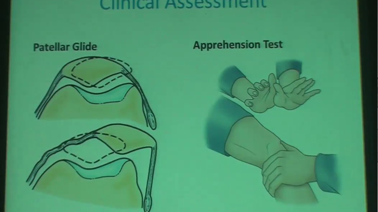 Patellar Instability, Prof.D.Maged  Samy