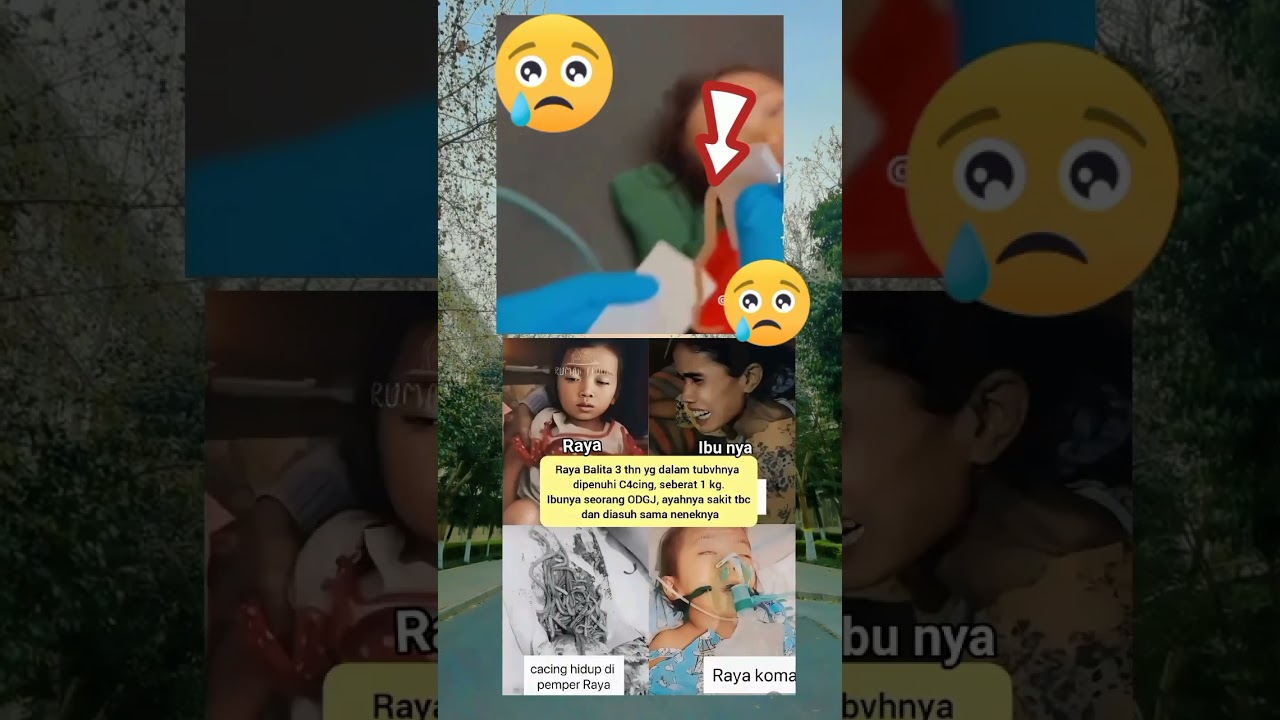 Berita viral dari sukabumi,adek Raya yg di diagnosa c4cingan akut #viral  #raya #sukabumi #kdm
