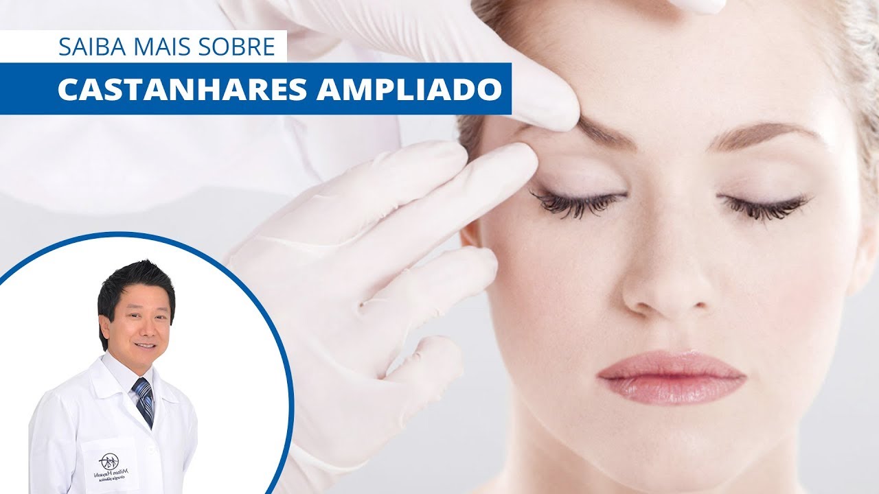 Castanhares Ampliado