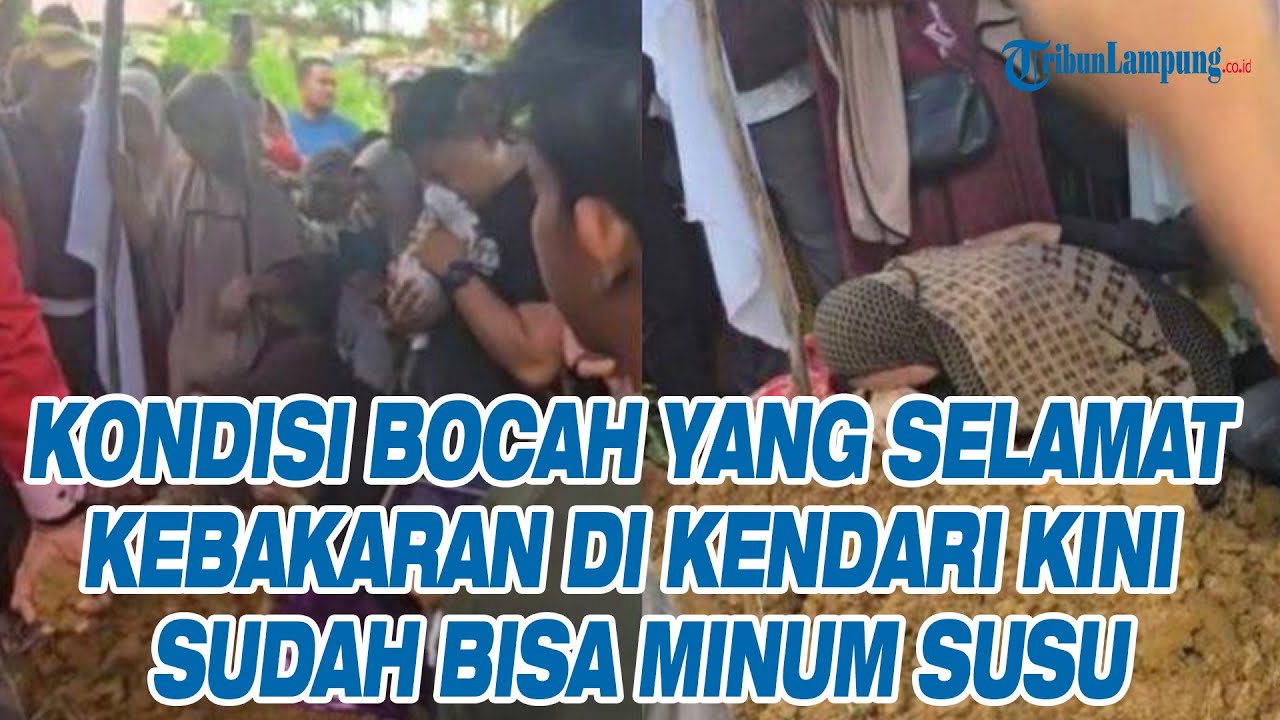 Kondisi Bocah yang Selamat Kebakaran di Kendari Kini Sudah Bisa Minum Susu