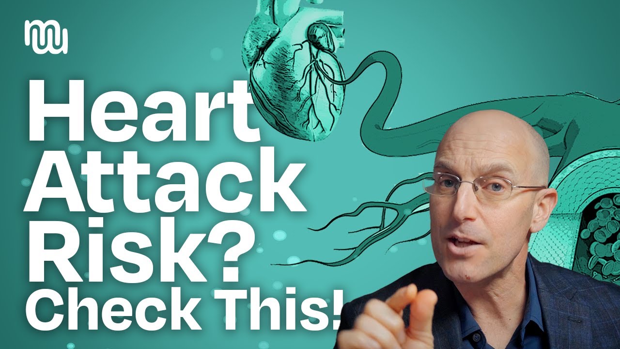 Early Heart Disease Detection? Why You May Consider a CIMT Test