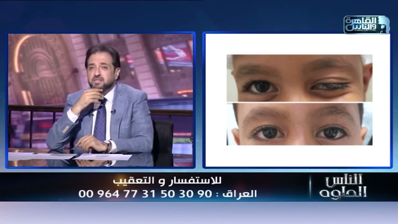 هل مريض وهن العضلات ممكن يعمل عملية؟