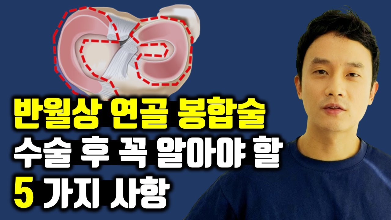 반월상 연골 봉합술 : 환자분께 꼭 설명 드리는 5 가지 사항