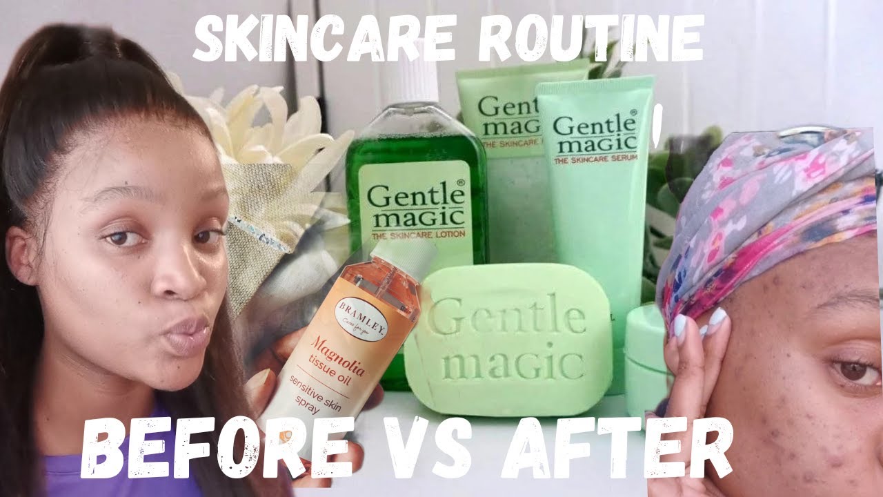 #skincareroutine|| Gentle magic products||Before Vs after #southafricanyoutuber