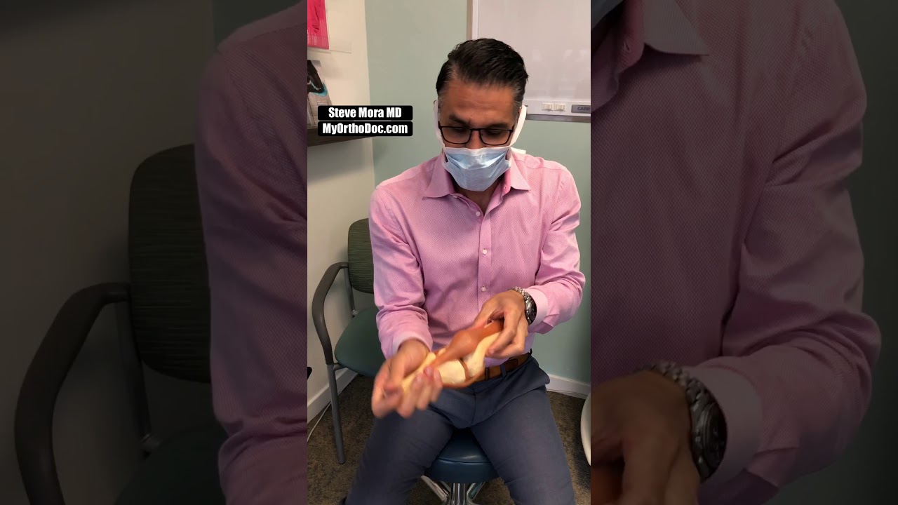 Patella (Knee Cap) Subluxation Pain