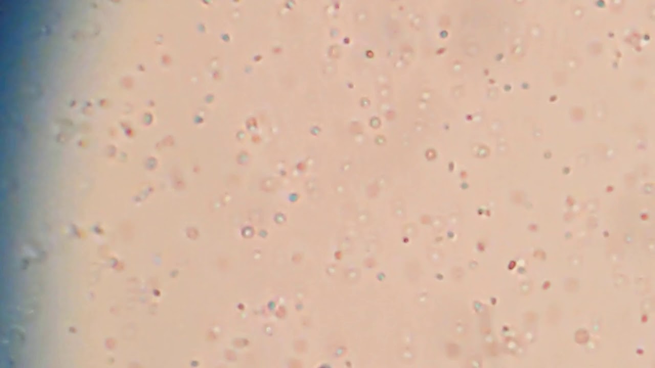 Dr Tim's Waste Away microscope view