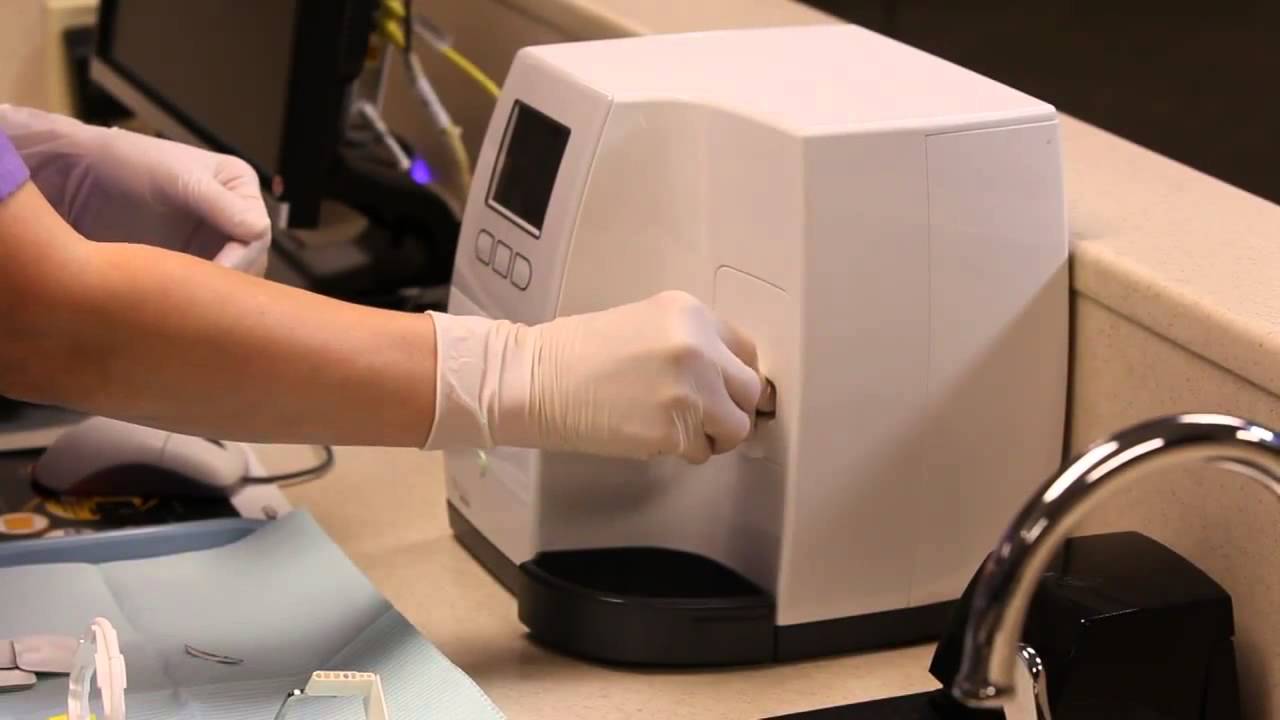 Henry Schein UK - CareStream CS7600 Workflow
