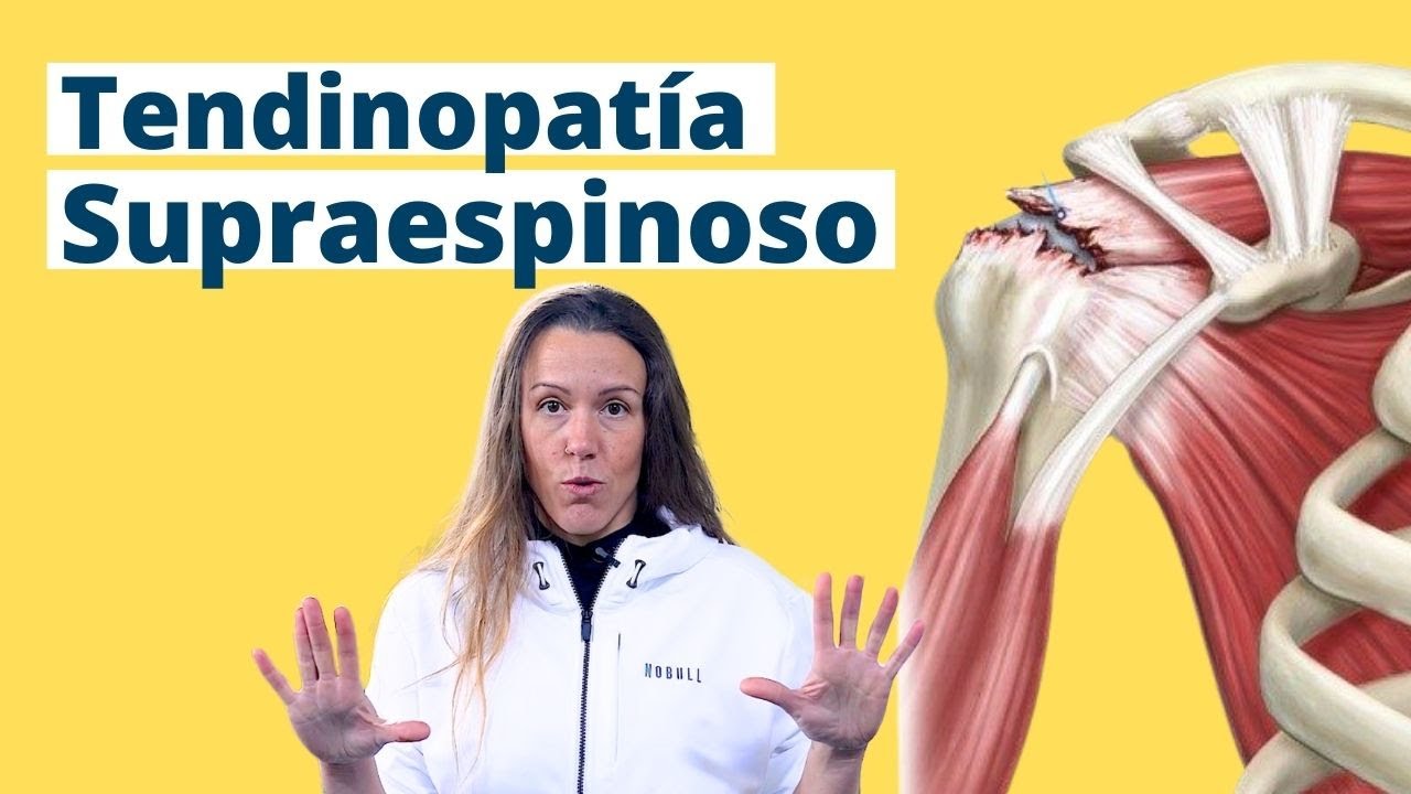 Tendinitis Supraespinoso - Ejercicios para aliviar tu Dolor de Hombro y Curar tu Tendón