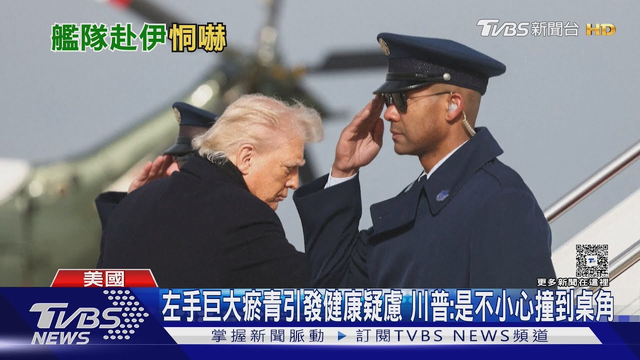 左手巨大瘀青引發健康疑慮 川普:是不小心撞到桌角｜TVBS新聞 @TVBSNEWS01