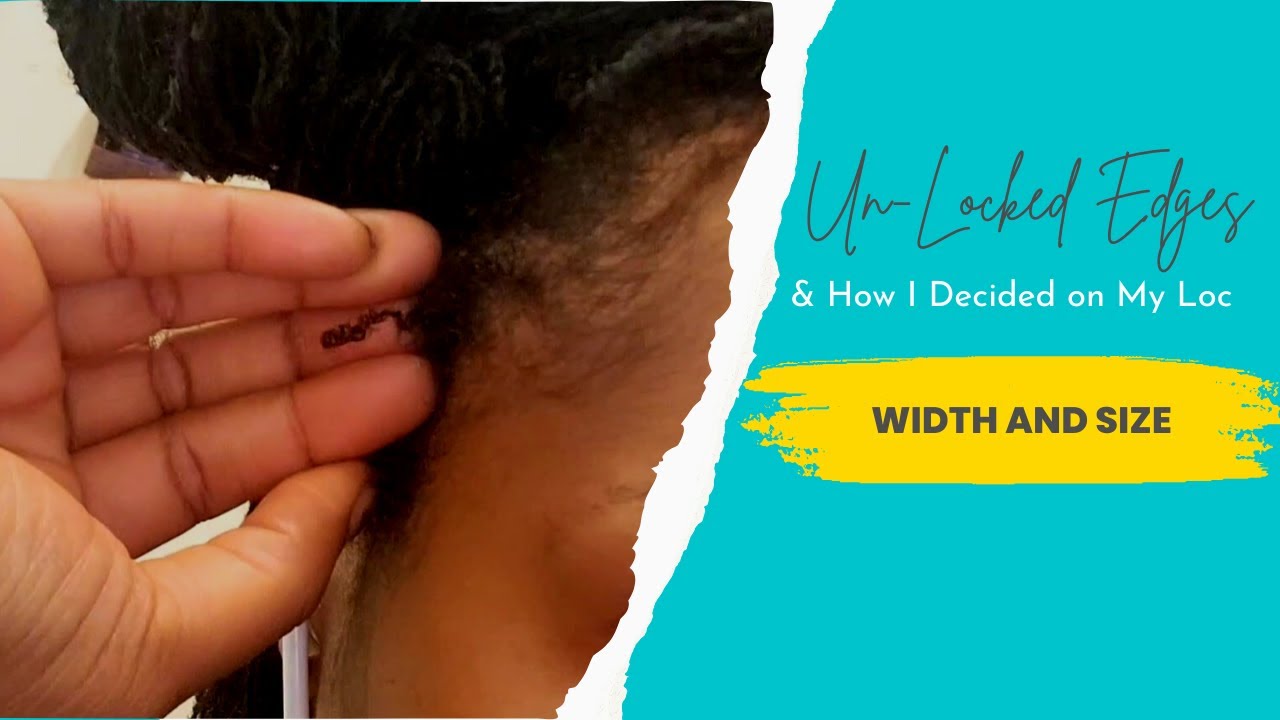 I Didn't Loc My Hairline?! Find Out Why, & Why My Locs are so TINY