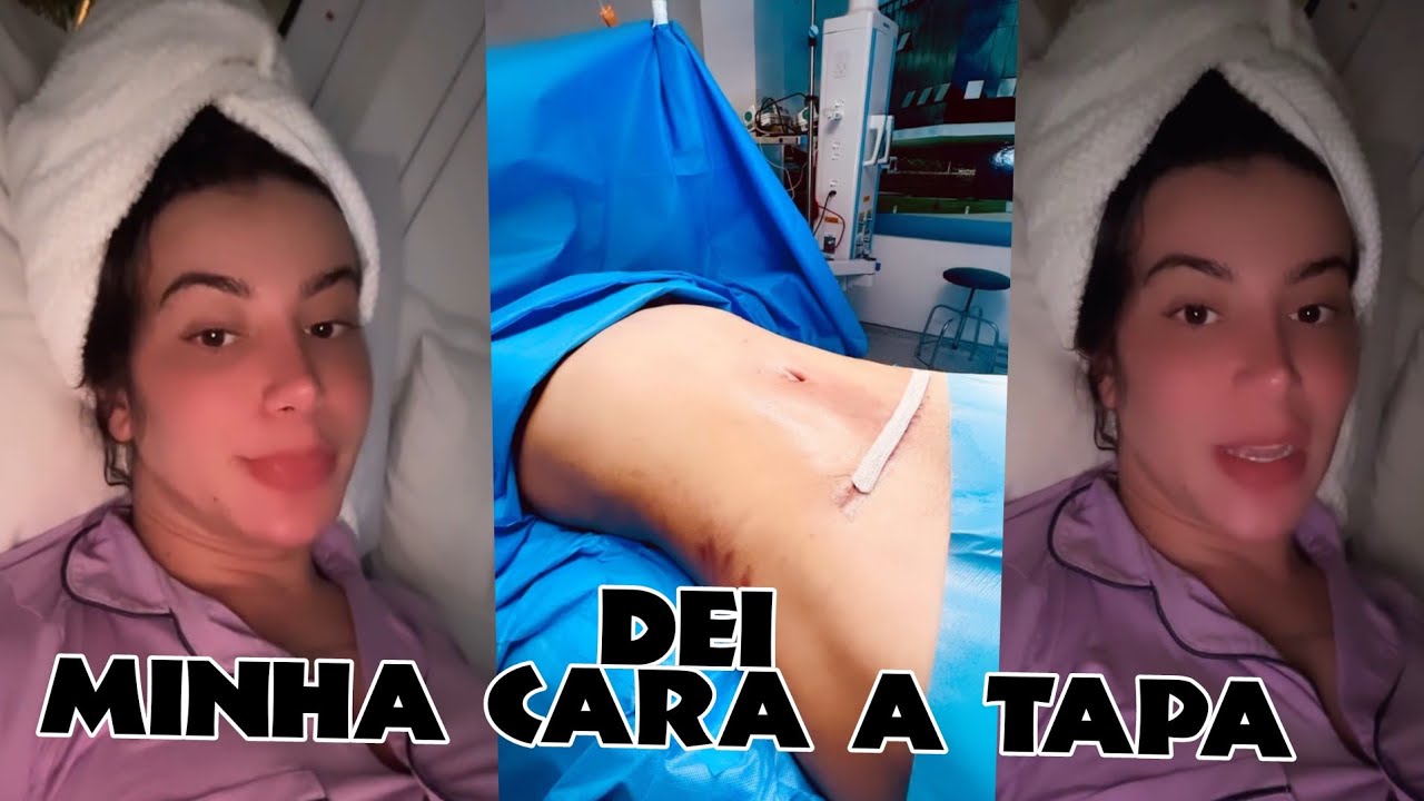 APOLINE😱REAPARECE E EXPLICA😨SOBRE A CIRUGIA QUE FEZ😔
